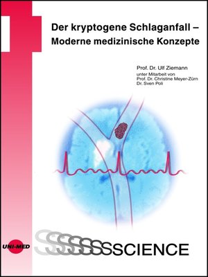 cover image of Der kryptogene Schlaganfall--Moderne medizinische Konzepte